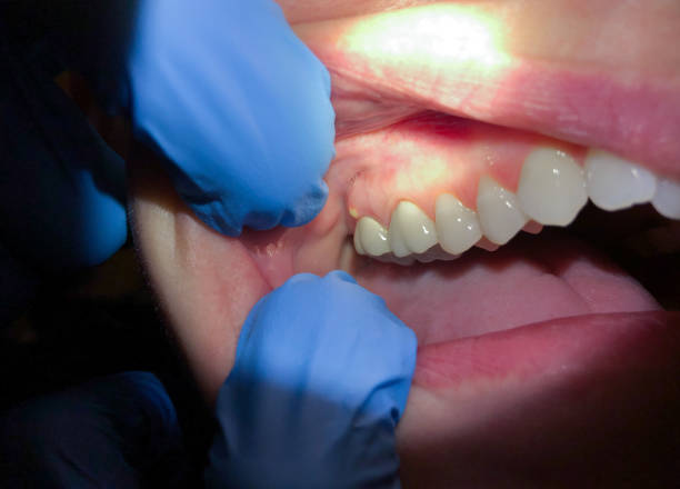 Best Emergency Broken Tooth Repair in New Egypt, NJ