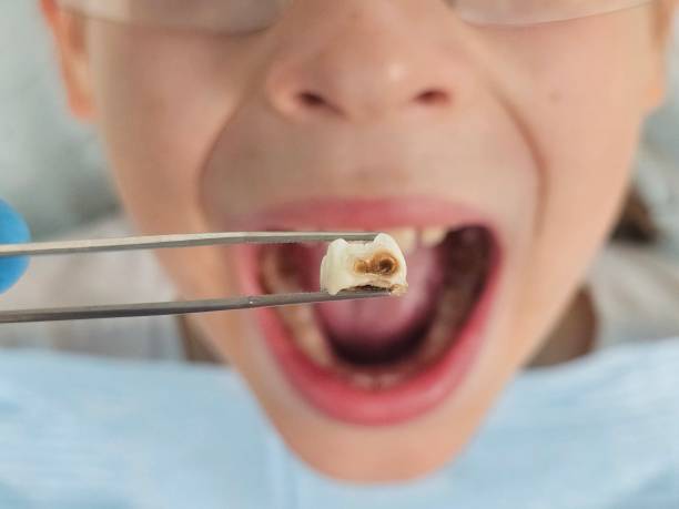 Best Emergency Treatment for Toothache in New Egypt, NJ